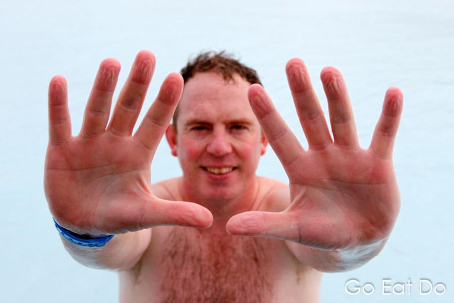 Travel blogger Stuart Forster shows his wrinked fingers after a long session of steeping in the heated pool of the Blue Lagoon in Iceland